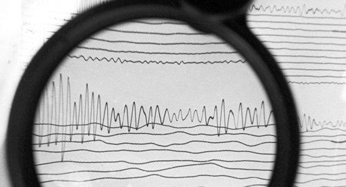 Сейсмограмма землетрясения Фото Sputnik/ Г. Копосов
https://sputnik-georgia.ru/incidents/20170901/237156878/Kaheti-trjaslo-magnituda-zemletrjasenija-v-Gruzii-sostavila-39.html
